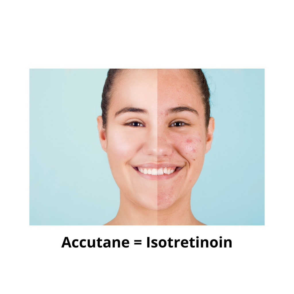 Post-Accutane Skincare: Why Estheticians Wait to Exfoliate | Trina Renea
