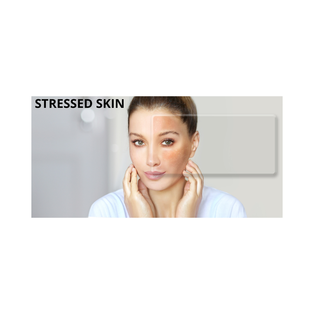 Stressed Skin? Your Products Aren't Enough
